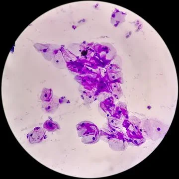 View in microscopic of human cervix cells or Squamous epithelial cells 스톡 사진