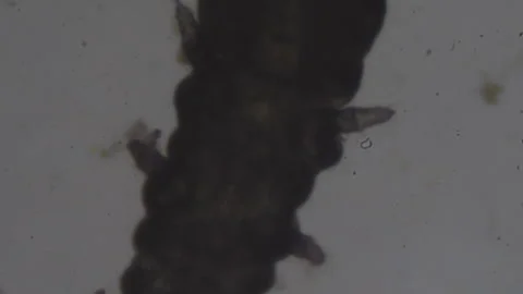 A view of a microscopic worm moving under a microscope. Stock Footage 279938418