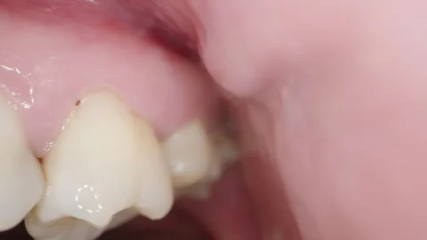View of Teeth Inside The Mouth Behind The Cheek, Macro Dental Examination. Vidéo 269606016