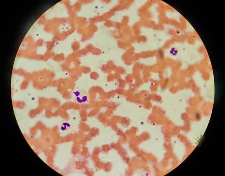 View through the microscope lens of platelet with virus colony. close up Stock Photos