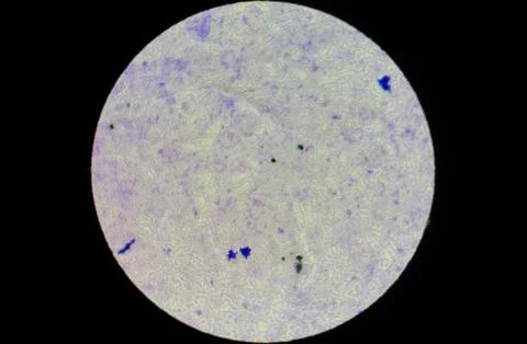 View through the microscope lens of platelet with virus colony. close up Stock Photos