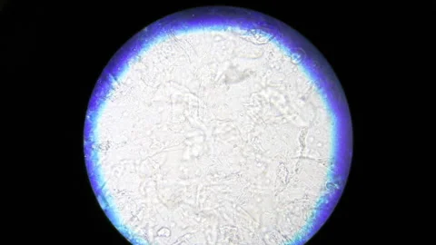 View through a microscope, moving microorganisms Stock Footage 283795601