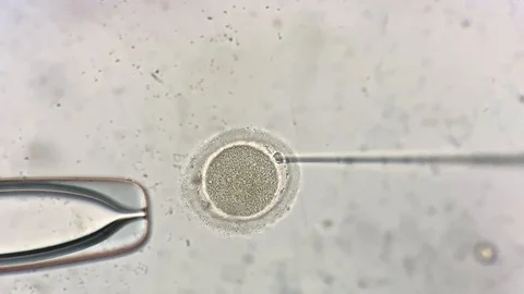 View through microscope at in vitro fertilization process Stock Footage 114192344