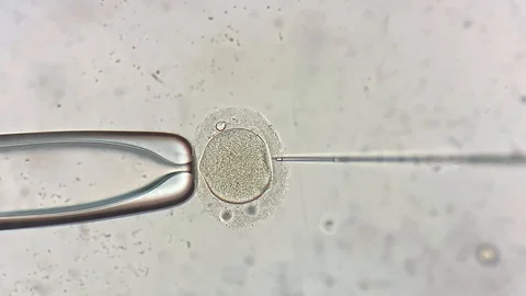 View through microscope at in vitro fertilization process Stock Footage 114192357