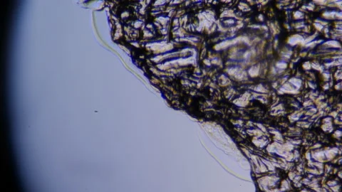View under a microscope. Solving the problem of malnutrition and resistance Stock Footage 153438440