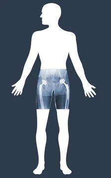Viewing analytics at Hologram human anatomy and skeleton. X-ray both hip Tota Stock Illustration