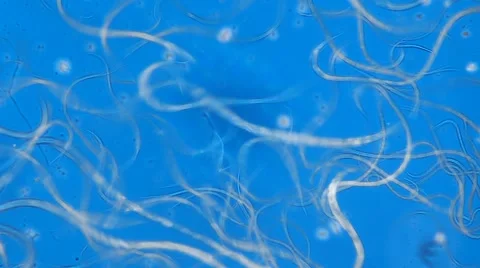 Vinegar Eel Vidéo 64856437