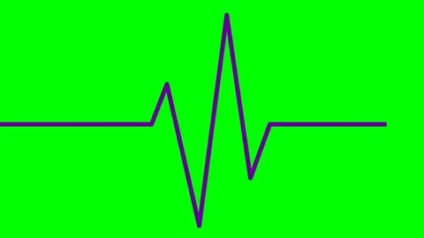 Violet line cardiogram green Stock Footage 237218630