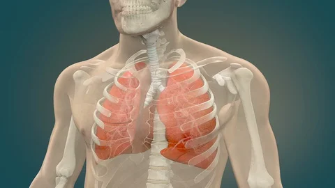 Viral pneumonia Stock Footage 127854353