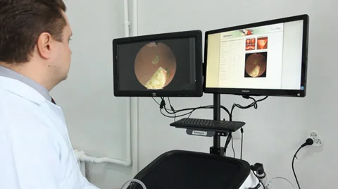 Virtual hysteroscopy simulator of the surgery (in work) Stock Footage 39789400