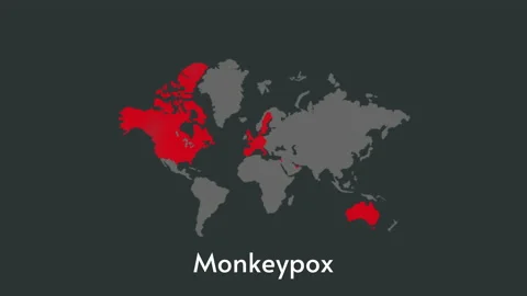 Virus 2022. Epidemic 2022 map of monkeypox. Vídeos de archivo 201047411