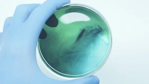 Virus and disease. Drop of blue luqvid.  Stock Footage 242804997