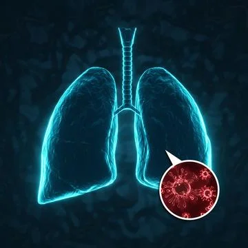Virus attacking the human lungs. Lungs disease Stock Illustration