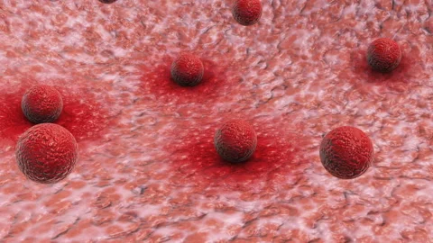 Virus cell attachment to human tissue 스톡 동영상 259734193