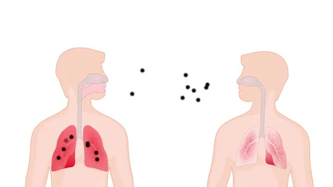Virus. human-to-human transmission. Vidéo 130800381