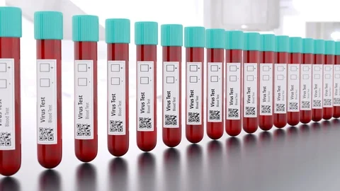 Virus Medical Test Tubes Camera Movement 動画素材 128527710