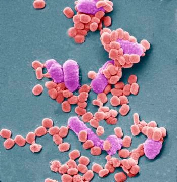 Virus particles and bacteria, SEM Foto stock