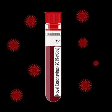 Virus simulation with Microbiological blood test results show positive for No 库存插图