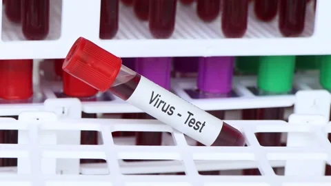 Virus test, blood sample to analyze in the laboratory Stock Footage 239625388