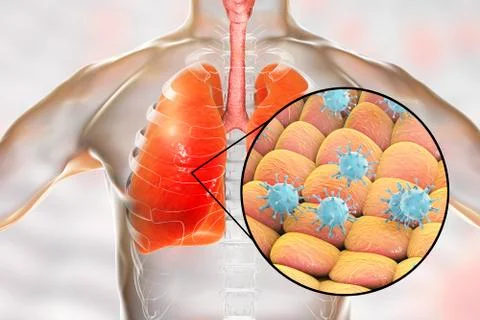 Viruses in human lungs Illustrazione stock