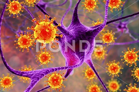 Viruses infecting neurons, concept for brain infection Stock Illustration
