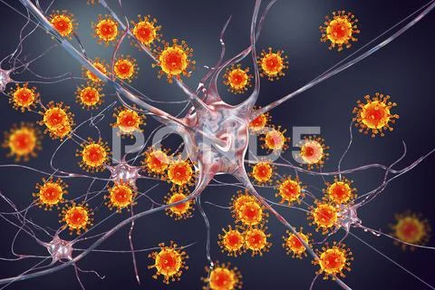 Viruses infecting neurons, concept for brain infection Stock Illustration