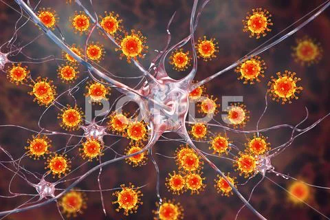 Viruses infecting neurons, concept for brain infection Stock Illustration