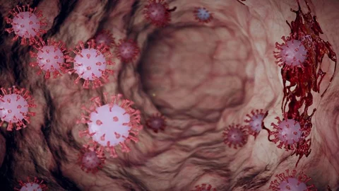 Virus.Infection Stock Footage 128122527