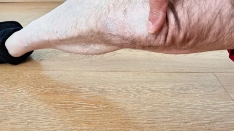 Visible Skin Changes on the Knee Showing Signs of Irritation and Aging 動画素材 347688095