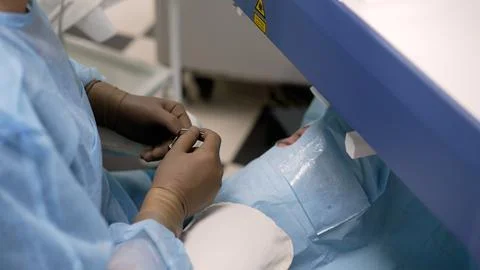 Vision correction procedure, doctor's hands in gloves, close-up. Cataract sur Stock Photos