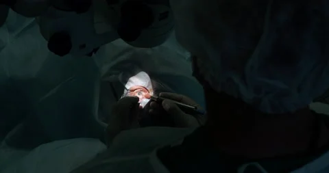 Vision correction. A surgeon during an eye operation in the operating room Video stock 154136609