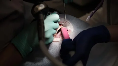 A visit to the dentist 스톡 동영상 307494007