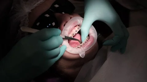 Visit to an orthodontist 스톡 동영상 307493403