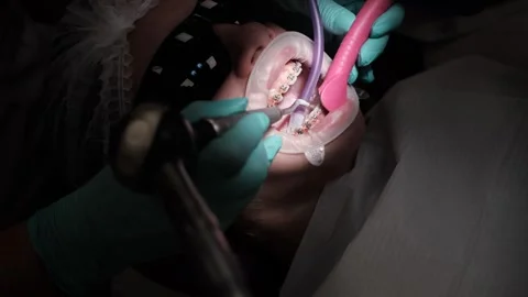 Visit to an orthodontist 스톡 동영상 307493457