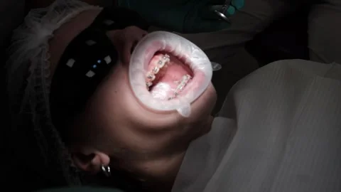 Visit to an orthodontist 스톡 동영상 307493485