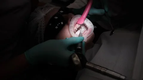 Visit to an orthodontist 스톡 동영상 307493521