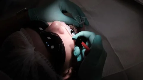 Visit to an orthodontist Stock Footage 307493666