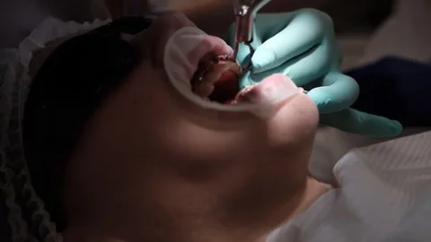 Visit to an orthodontist 스톡 동영상 307493733