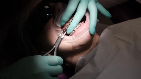 Visit to an orthodontist 스톡 동영상 307493734