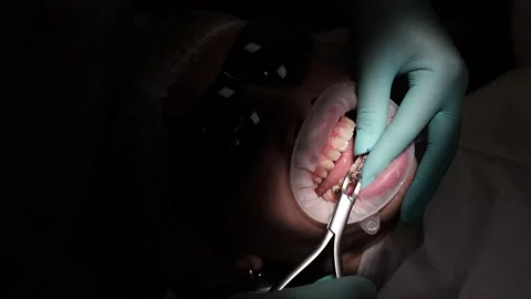 Visit to an orthodontist Stock Footage 307493743