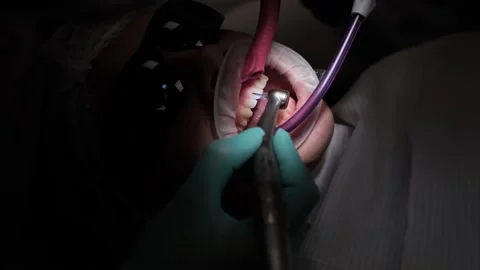 Visit to an orthodontist Stock Footage 307493788
