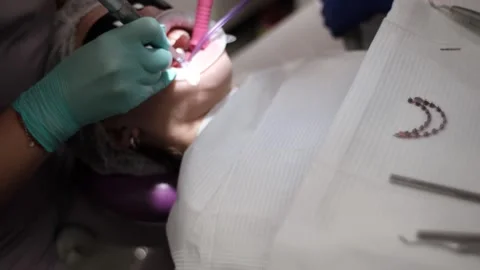 Visit to an orthodontist Stock Footage 307493812