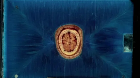 Visual Human Project (Female) Stock-Footage 64857025