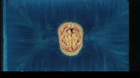 Visual Human Project (Male) Vidéo 64856984