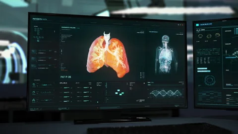 Visualization Of Lungs In Modern medical Scientific Software On Computer Screen Stock Footage 270338680
