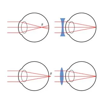 Visually impaired and their correction 스톡 일러스트
