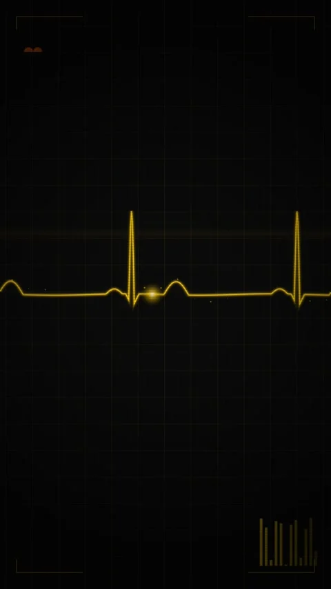 Vital signs electrocardiogram graph display: abstract heart rate rhythm mon.. Stock Footage 345493239
