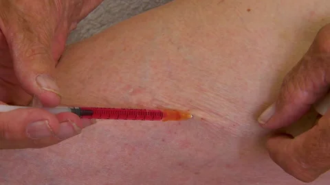 Vitamin B12 injection 動画素材 156793823