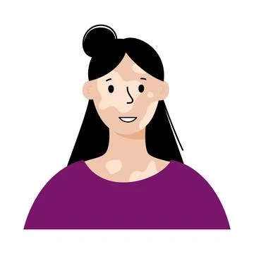 Vitiligo day concept Stock Illustration