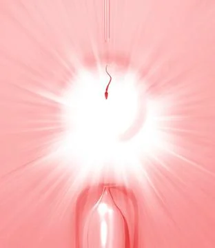 In vitro fertilisation, artwork Stock Illustration